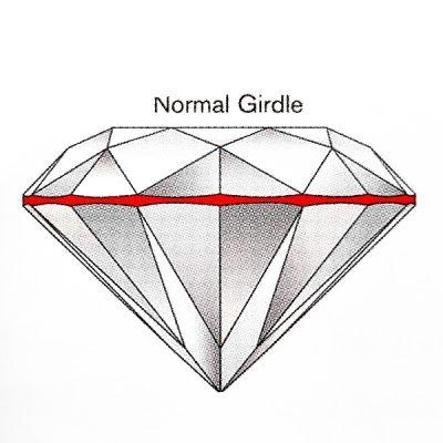 girdle-normal-ปกติ-เกอเดิล